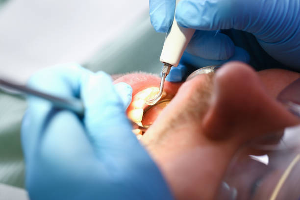 Best Emergency Dental Care for Broken or Chipped Teeth in Colonial Heights, TN